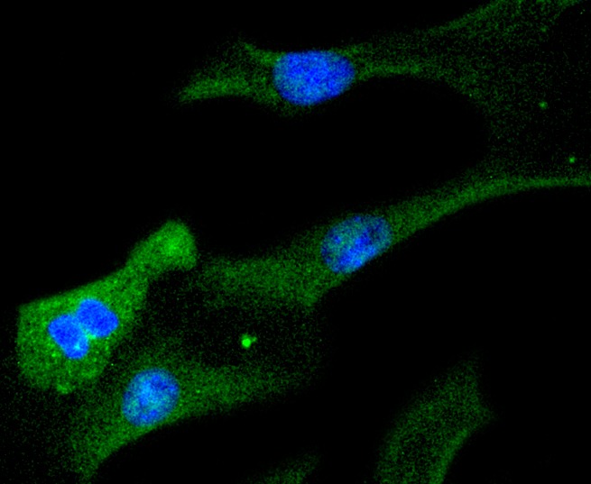 Anti-STAT6 Antibody (1F266)