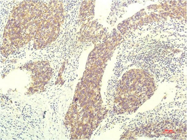 Anti-STAT1 Antibody (7W405)
