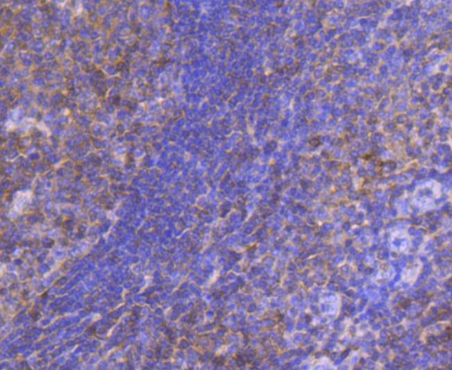 Anti-STAT5A/B Antibody (8D628)