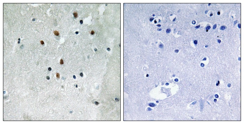 Anti-Phospho-SRF (Ser77) Polyclonal Antibody