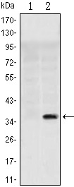 Anti-SLC22A1 Antibody (6Q395)