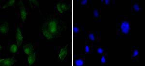 Anti-SOX11 Antibody (4S363)