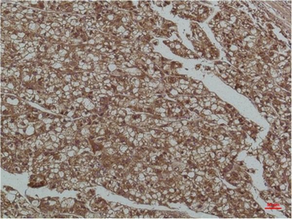 Anti-SMAD3 Antibody (8N368)