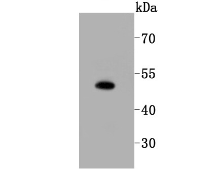 Anti-Sphingosine Kinase 1/SPHK1 Antibody (6L121)