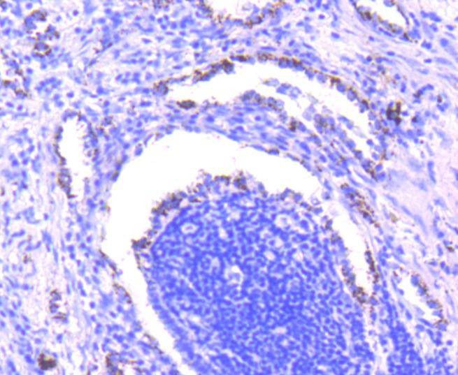 Anti-SMAD3 Antibody (6Y358)
