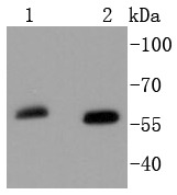 Anti-SOX10 Antibody (2U475)
