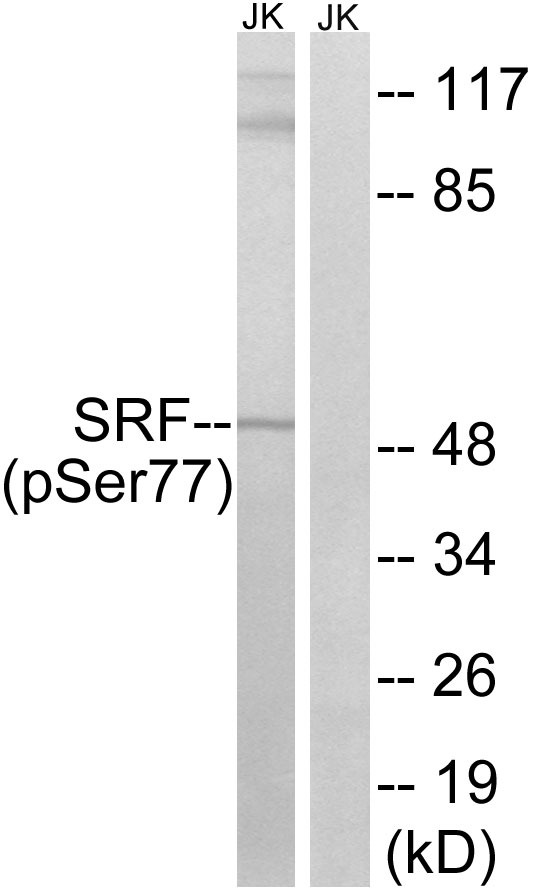 Anti-Phospho-SRF (Ser77) Polyclonal Antibody