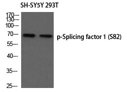 Anti-Phospho-Splicing factor 1 (Ser82) Polyclonal Antibody