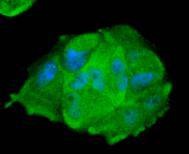 Anti-STAT1 Antibody (5F189)