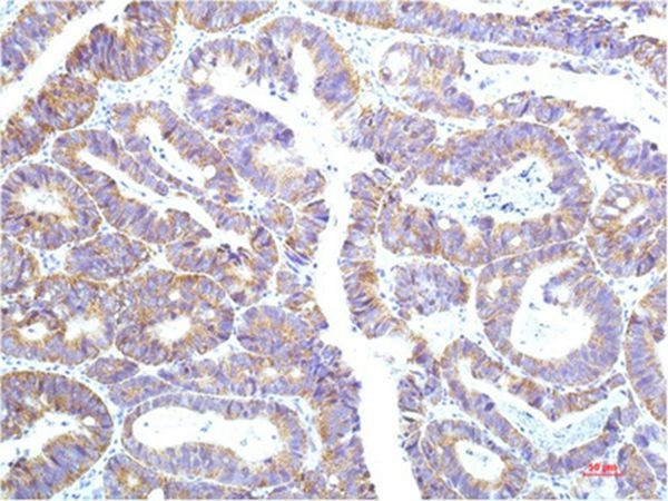 Anti-STAT1 Antibody (7W405)