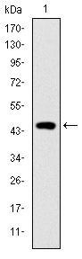 Anti-TNNI2 Antibody (1Z708)