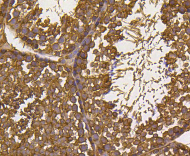 Anti-UBB Antibody (3A357)