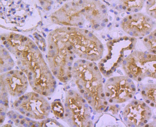 Anti-Ubiquitin Activating Enzyme E1/UBA1 Antibody (1V154)