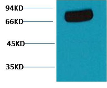 Anti-Transferrin Antibody (9R664)