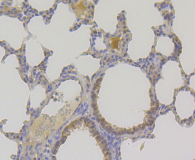 Anti-TNPO3 Antibody (8G85)