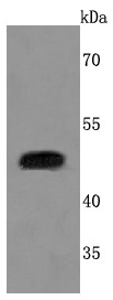 Anti-PLAU/uPA Antibody (8V289)