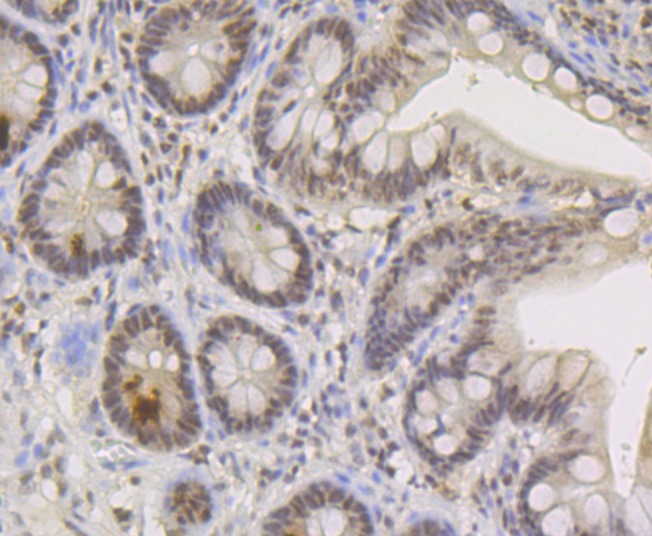 Anti-TNPO3 Antibody (8G85)