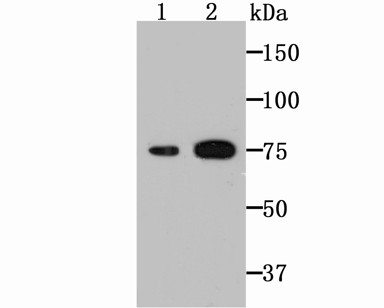 Anti-TGM2 Antibody (9X389)
