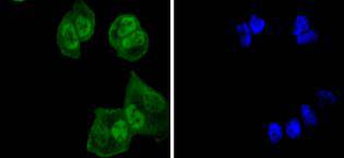 Anti-Ubiquitin Activating Enzyme E1/UBA1 Antibody (1V154)