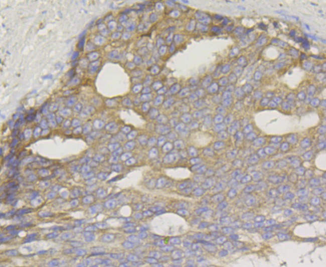 Anti-TREX1 Antibody (9A314)