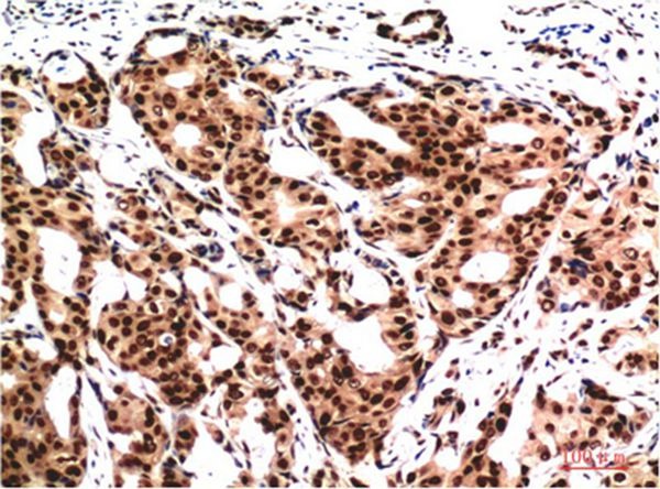 Anti-UBB Antibody (2C730)