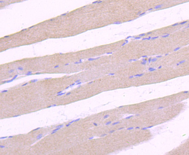 Anti-ULK1 Antibody (6P282)