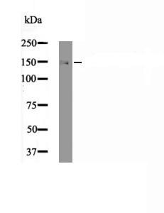 Anti-Phospho-ULK1 (Ser757) Polyclonal Antibody