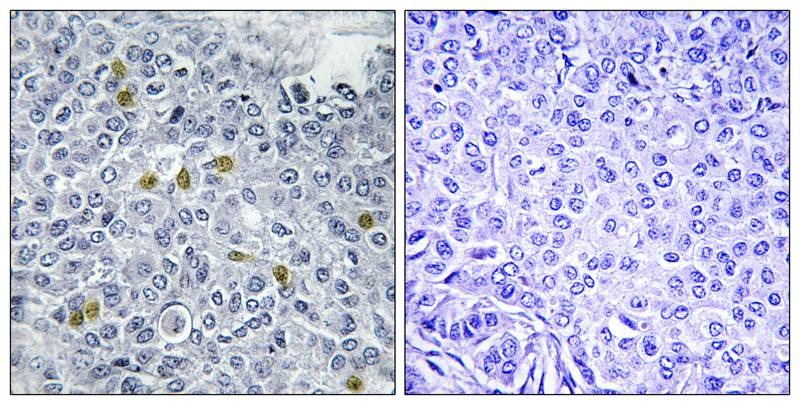 Anti-Phospho-TOP2A (Ser1106) Polyclonal Antibody 2