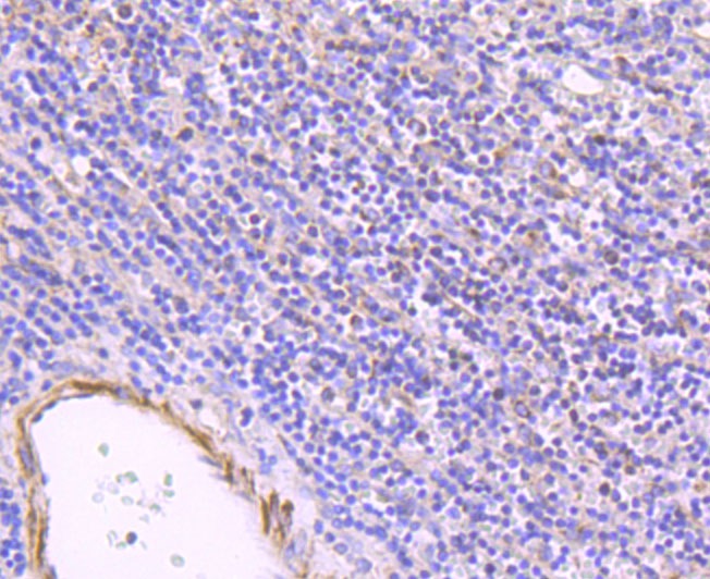Anti-ULK1 Antibody (6P282)