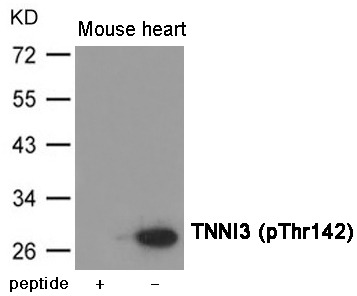 Anti-Phospho-TNNI3 (Thr142) Polyclonal Antibody 2