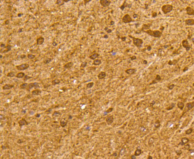 Anti-UBB Antibody (3A357)