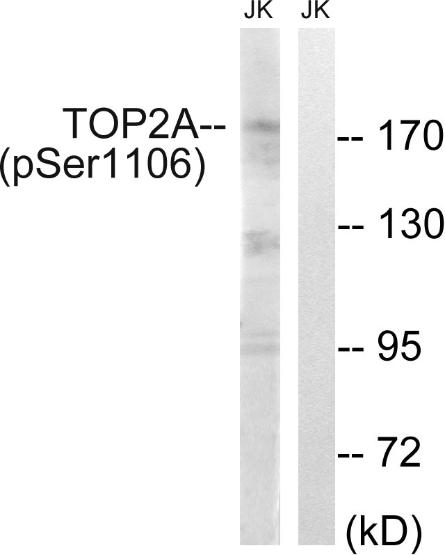 Anti-Phospho-TOP2A (Ser1106) Polyclonal Antibody 2