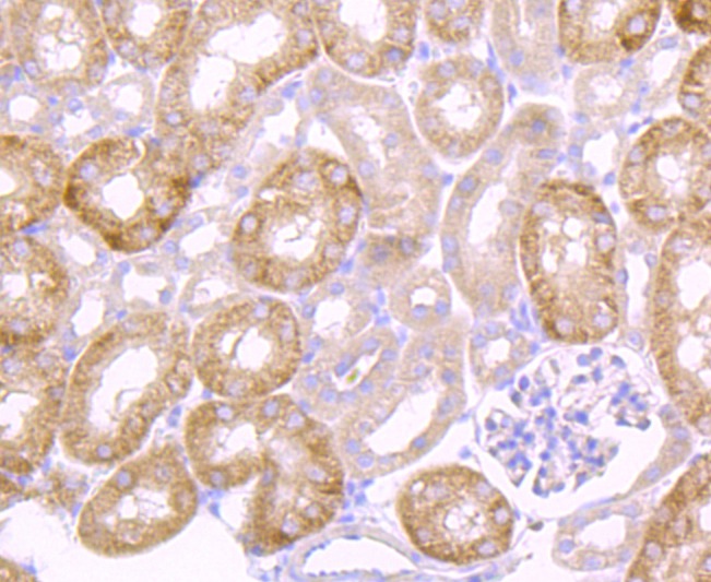 Anti-PLAU/uPA Antibody (8V289)