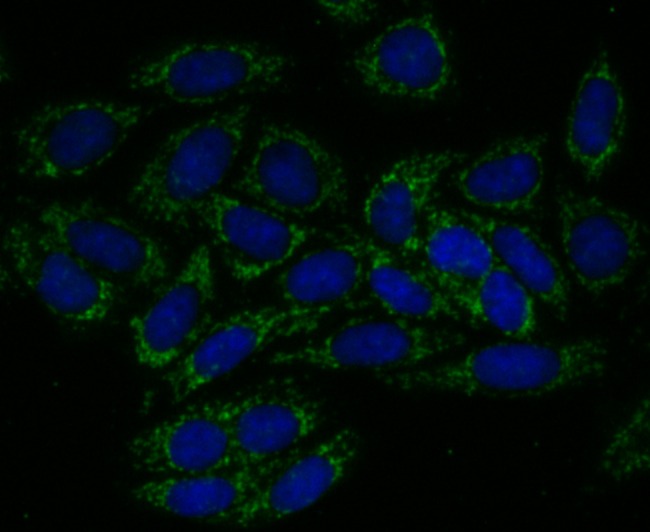 Anti-TREX1 Antibody (9A314)
