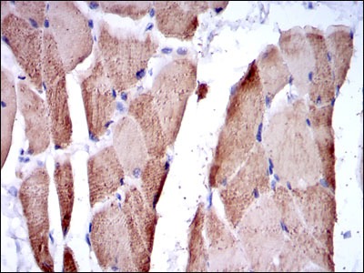 Anti-TNNI2 Antibody (1Z708)