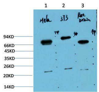 Anti-UBB Antibody (2C730)