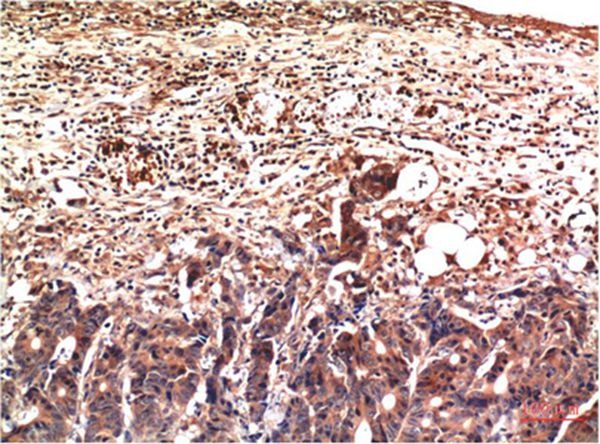 Anti-UBB Antibody (8Y6)