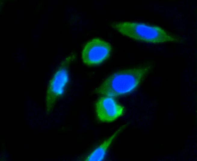 Anti-UBB Antibody (3A357)