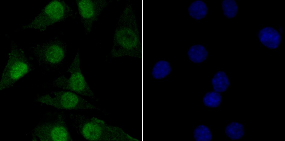 Anti-TNPO3 Antibody (8G85)