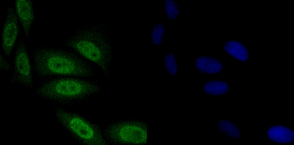 Anti-TNPO3 Antibody (8G85)