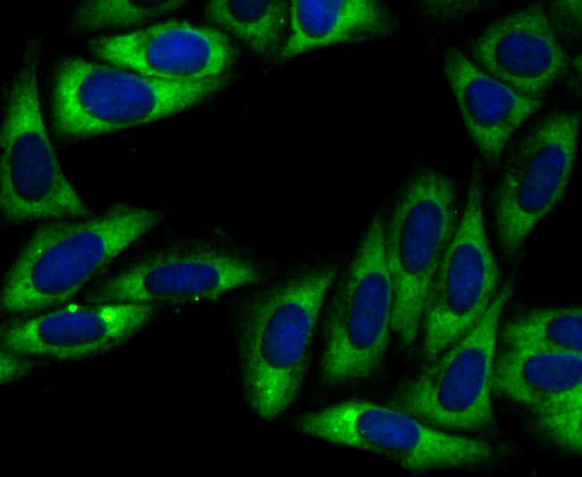 Anti-UQCRFS1 Antibody (8G153)