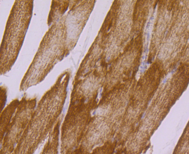 Anti-UQCRFS1 Antibody (8G153)