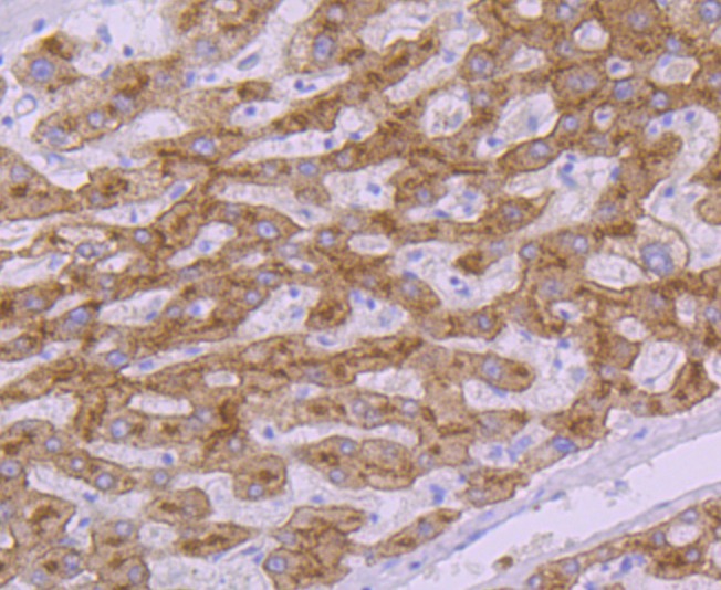 Anti-Transferrin R2 Antibody (5U818)