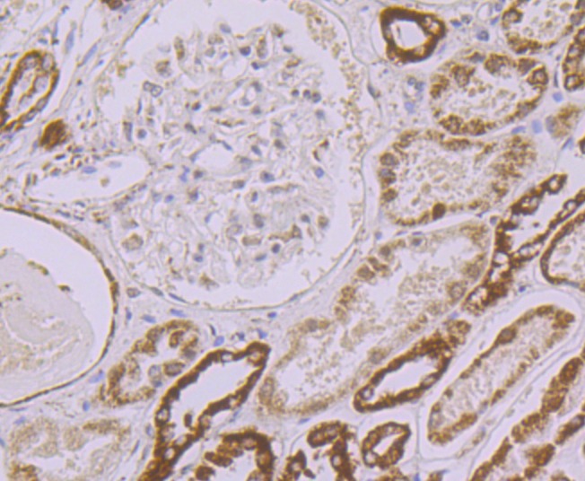 Anti-UQCRFS1 Antibody (8G153)