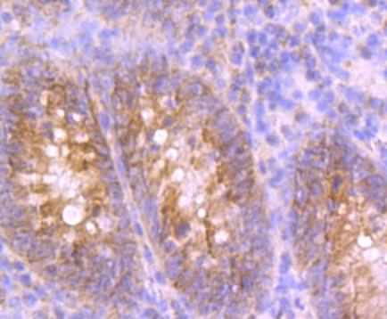 Anti-UQCRFS1 Antibody (8G153)