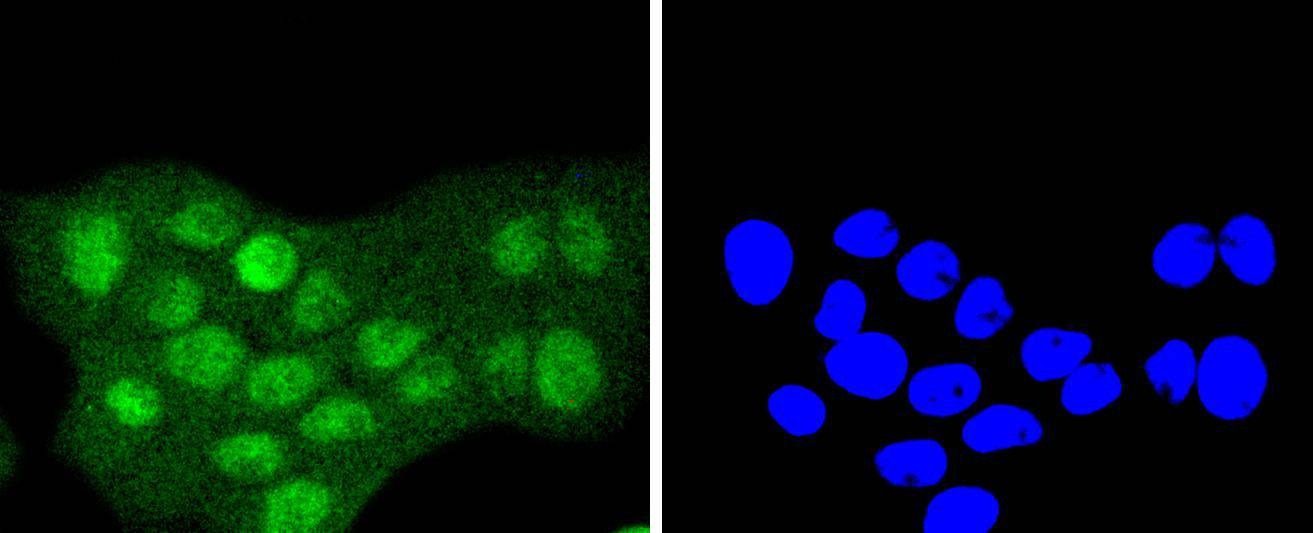 Anti-SUMO3 Antibody (9E189)