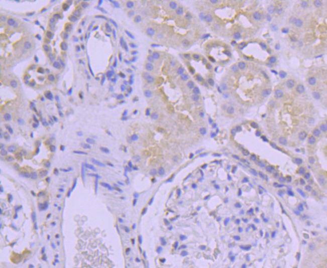 Anti-SUMO3 Antibody (9E189)