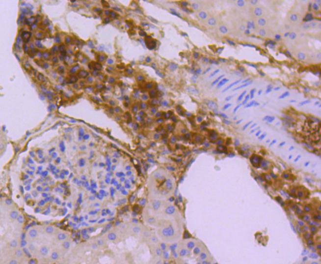 Anti-SUMO3 Antibody (9E189)