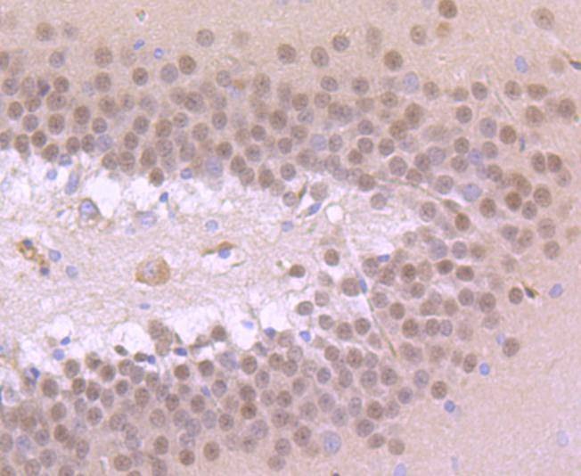 Anti-TBR1 Antibody (1Z281)