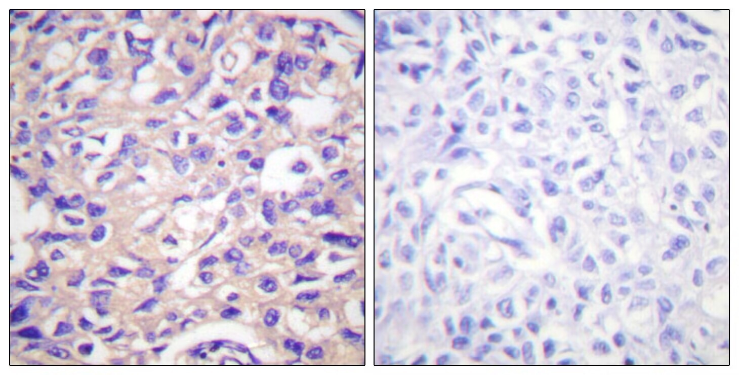 Anti-Phospho-TK1 (Ser13) Polyclonal Antibody